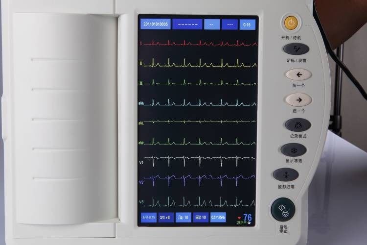 Menselijke ECG-machine hartonderzoek cardiologie 12-kanaals ECG-machine ekg elektrocardiogram machine ECG