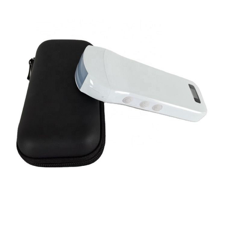 Usg New Look 3d Image GYN Image Laptop Ob Gyn Fetale Ultrasone Machine Kleur Doppler met hoge kwaliteit