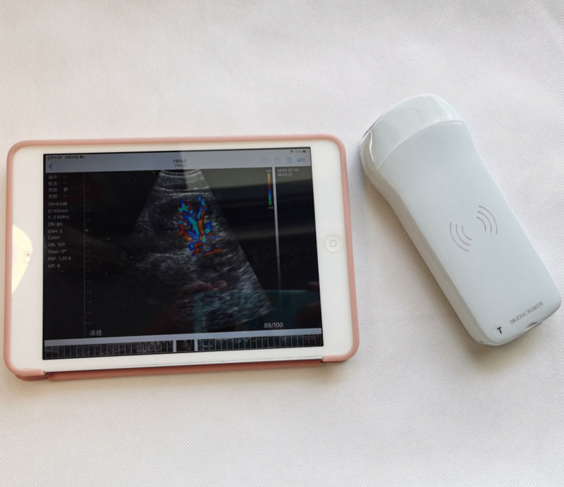 Usg New Look 3d Image GYN Image Laptop Ob Gyn Fetale Ultrasone Machine Kleur Doppler met hoge kwaliteit