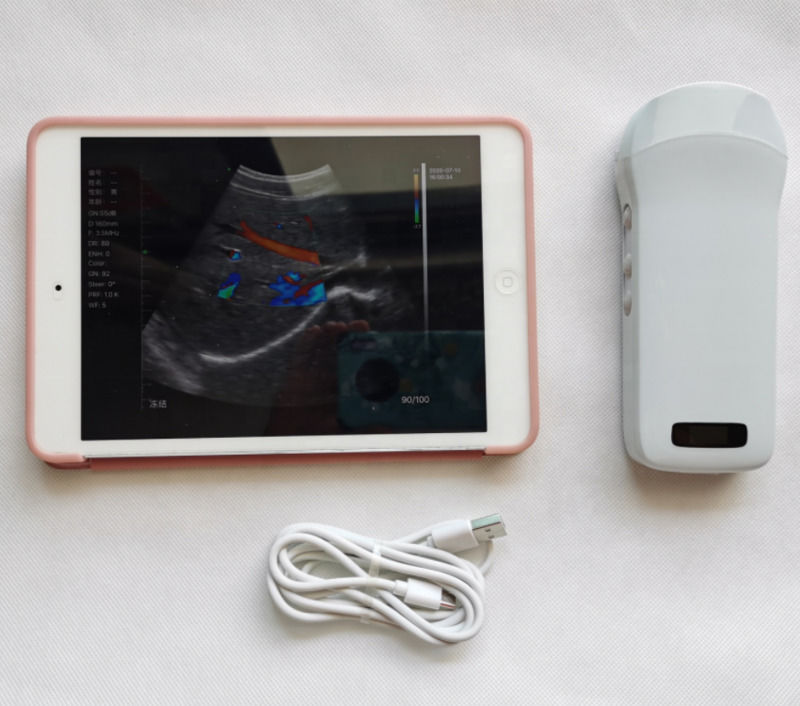 Usg New Look 3d Image GYN Image Laptop Ob Gyn Fetale Ultrasone Machine Kleur Doppler met hoge kwaliteit