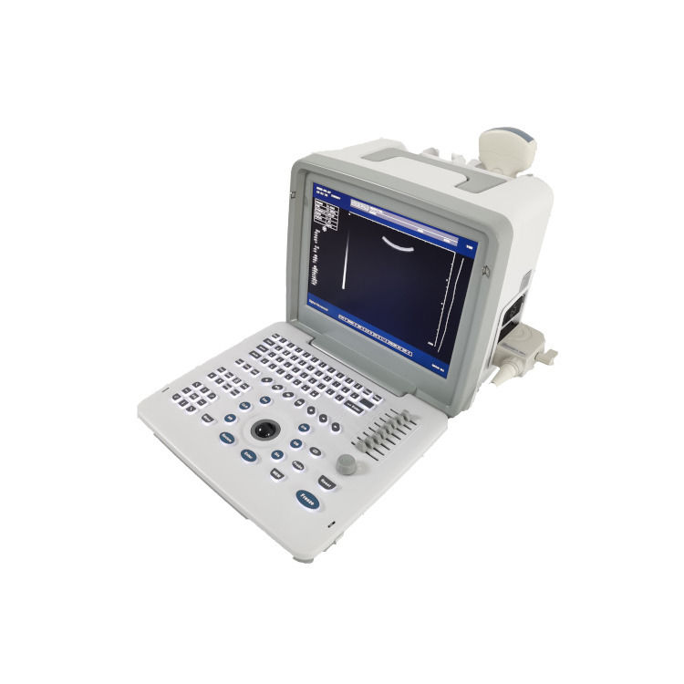Metalen Zie Laptop B W Draagbare Zwangerschap Doppler Probe Scanner Radio Foetaal Echografie Apparaat Voor Baby