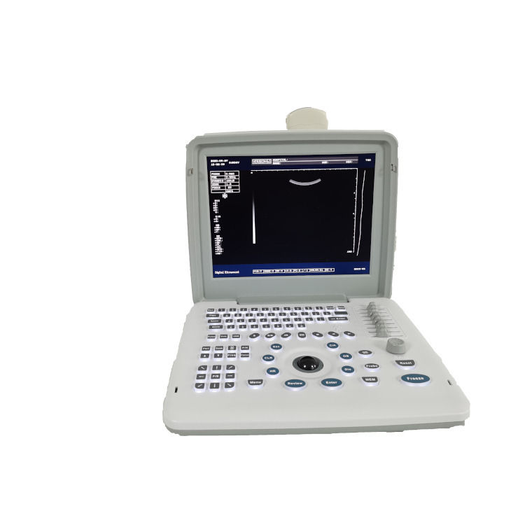 Metalen Zie Laptop B W Draagbare Zwangerschap Doppler Probe Scanner Radio Foetaal Echografie Apparaat Voor Baby