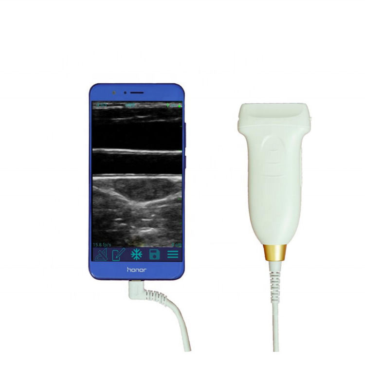 GYN echografie probe convex wifi usb draadloze echografie probes voor android