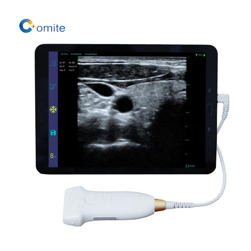 GYN echografie probe convex wifi usb draadloze echografie probes voor android