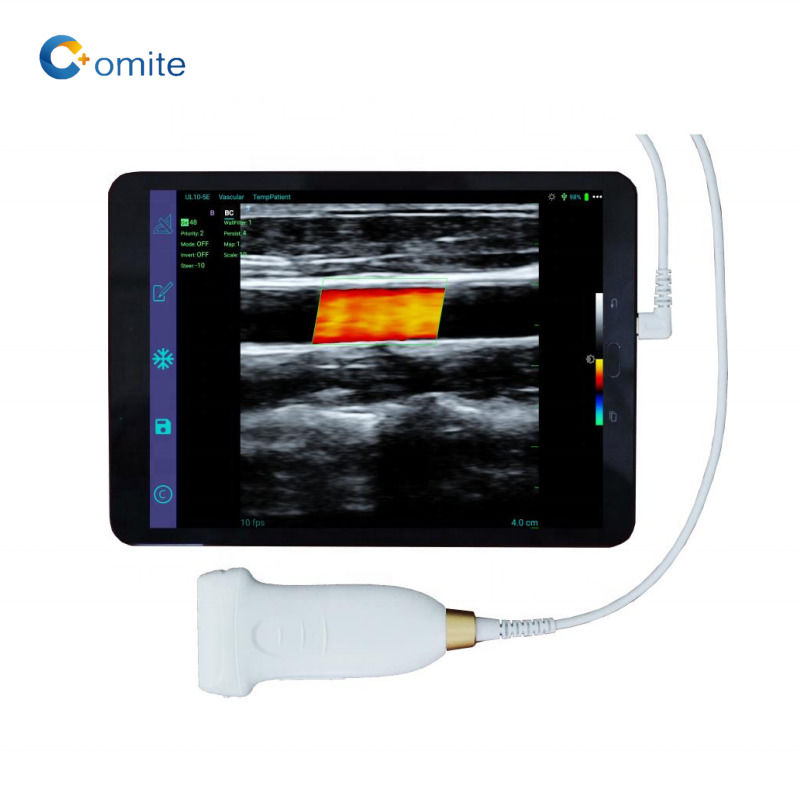 GYN echografie probe convex wifi usb draadloze echografie probes voor android