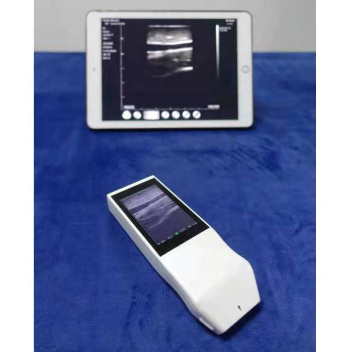 WIFI draadloze kleursonde GYN Ultrasound Lineaire sonde met display Anesthesie Punctie Navigatie Handheld Ultrasound