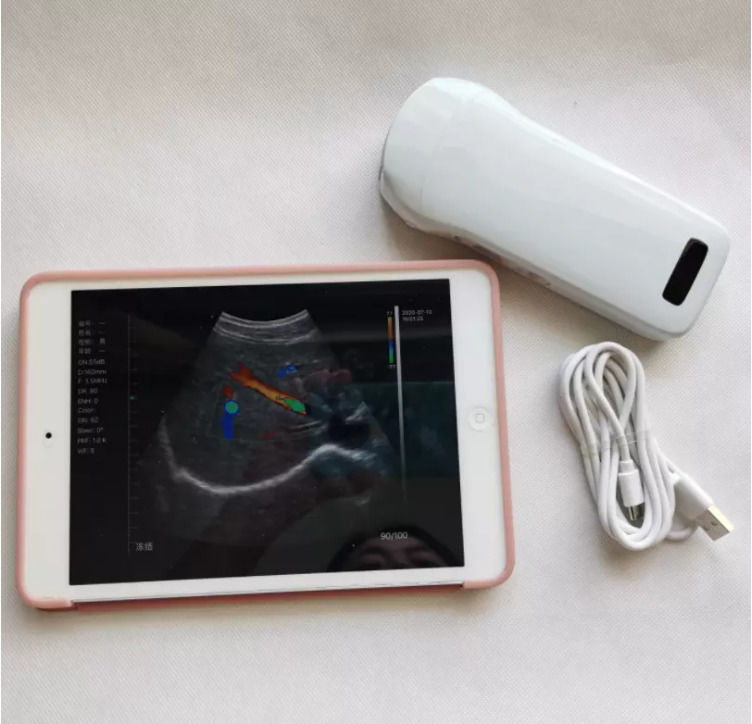 GYN Ultrageluid Instrumenten Draadloze Draagbare Klinische Probe Analytische Instrumenten Mobiele Ultrageluidmachine