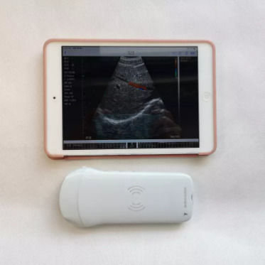 GYN Ultrageluid Instrumenten Draadloze Draagbare Klinische Probe Analytische Instrumenten Mobiele Ultrageluidmachine