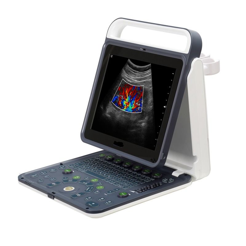 Ziekenhuis Buiten 2020 Nieuwe Draagbare Digitale 15 Inch Kleuren Doppler Echografie Machine