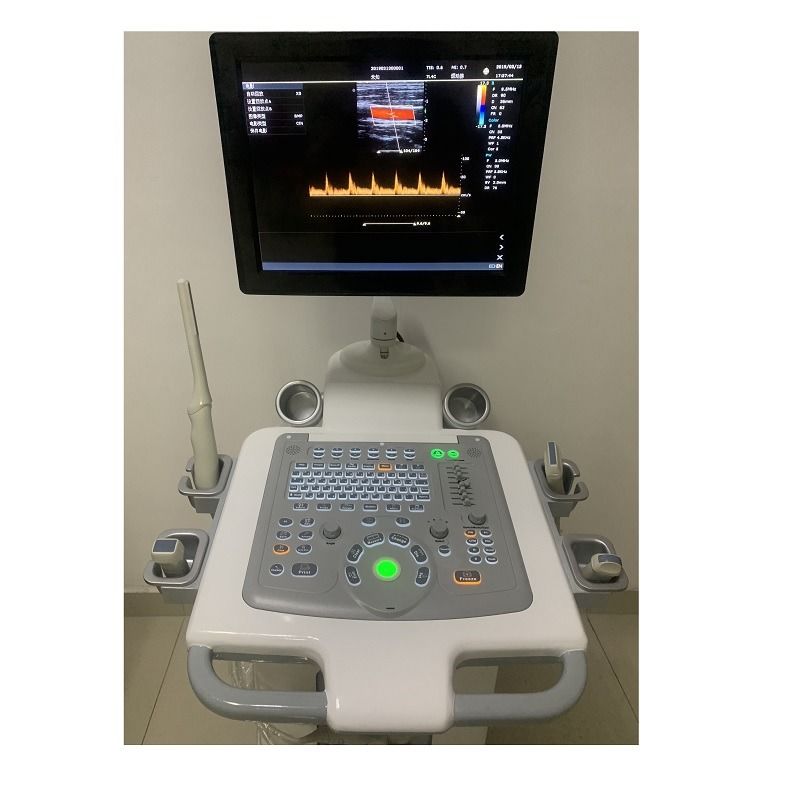 Ziekenhuis Buitenwagen 15 inch Ultrasoon Apparaat Ultrageluid Digitale Kleuren Doppler Ultrageluid Machines Medisch