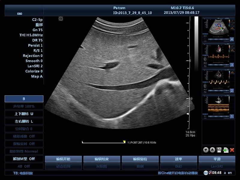 Ziekenhuis Buitenwagen 15 inch Ultrasoon Apparaat Ultrageluid Digitale Kleuren Doppler Ultrageluid Machines Medisch