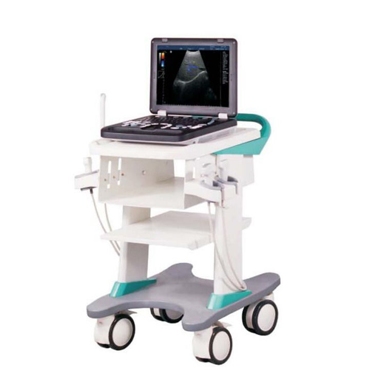100% gegarandeerd Draagbare Kleur Doppler Ultrasound Echokardiografie Echo Ultrasound Machine