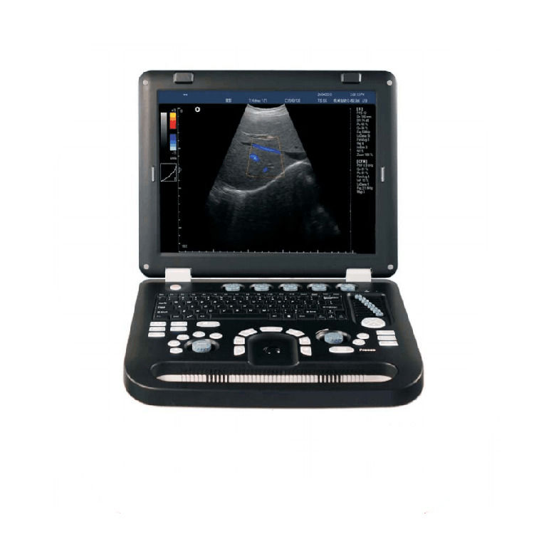 100% gegarandeerd Draagbare Kleur Doppler Ultrasound Echokardiografie Echo Ultrasound Machine