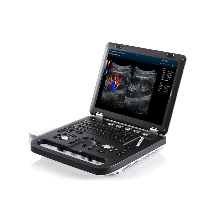 100% gegarandeerd Draagbare Kleur Doppler Ultrasound Echokardiografie Echo Ultrasound Machine