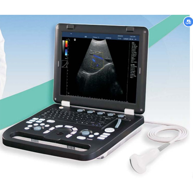 100% gegarandeerd Draagbare Kleur Doppler Ultrasound Echokardiografie Echo Ultrasound Machine