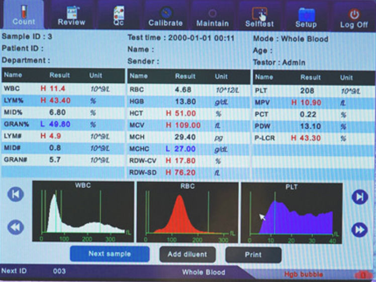Klinische analytische volledig automatische hematologische instrumenten Bloedcelanalyseur Comite Plus Volledig automatische hematologische analyseur CMT-800