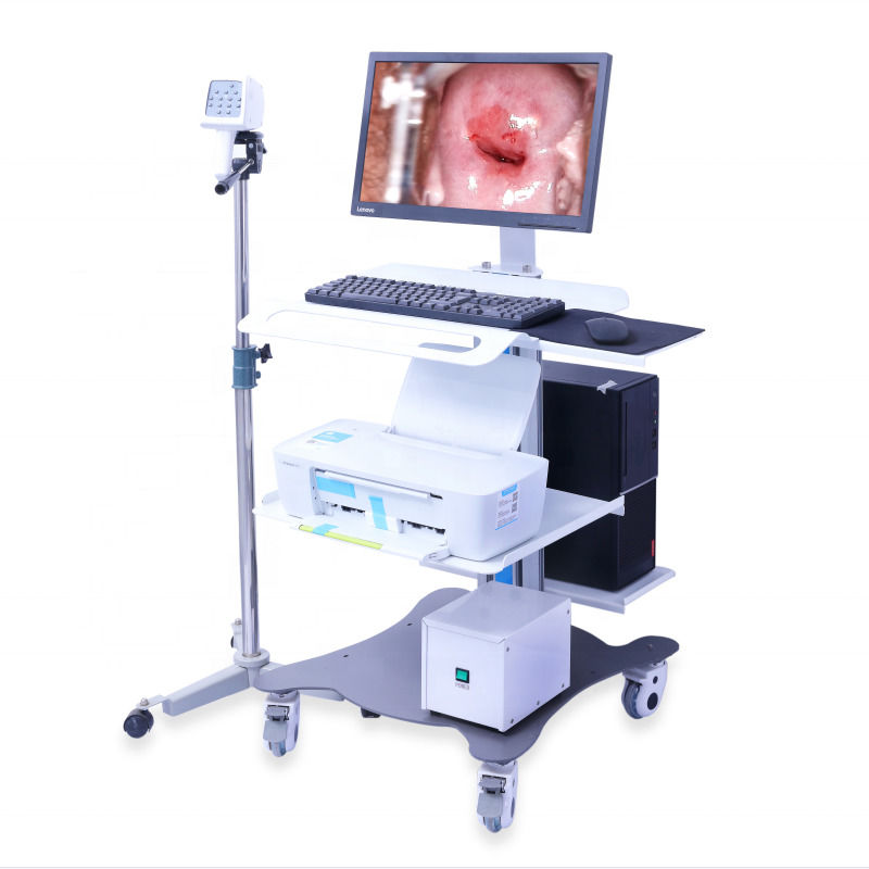 Draagbare GYN Colposcope Digitaal Colposcope Imaging System Vagina Onderzoek Video Colposcope Voor Gynecologie