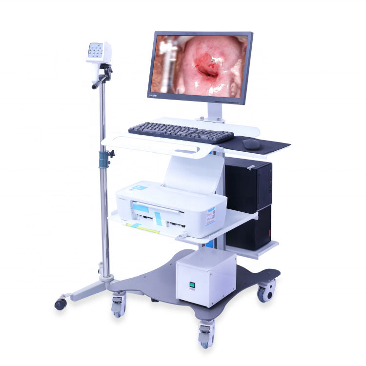 Draagbare GYN Colposcope Digitaal Colposcope Imaging System Vagina Onderzoek Video Colposcope Voor Gynecologie