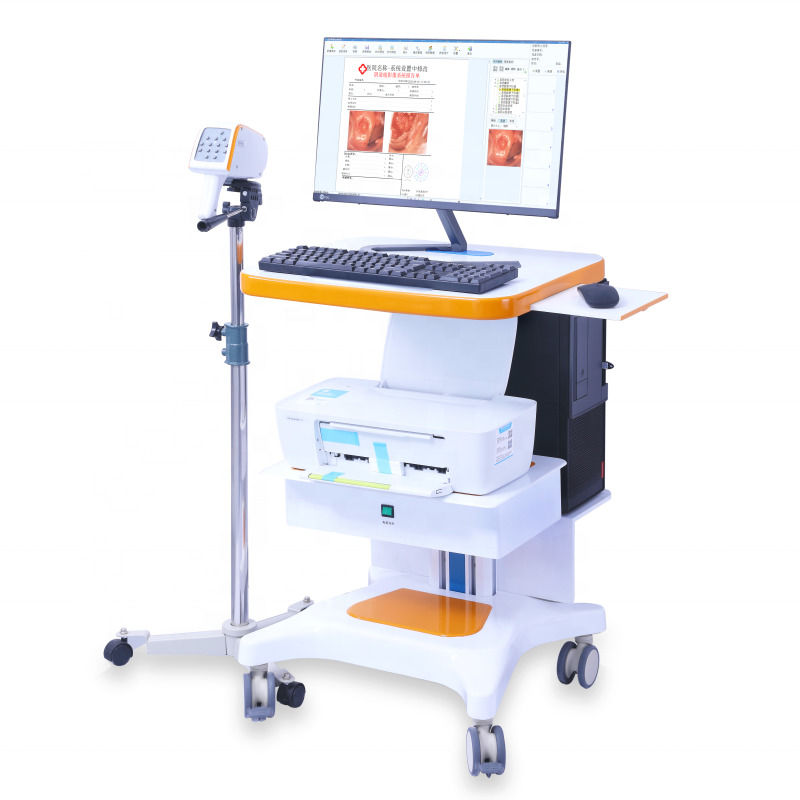 Draagbare GYN Colposcope Digitaal Colposcope Imaging System Vagina Onderzoek Video Colposcope Voor Gynecologie